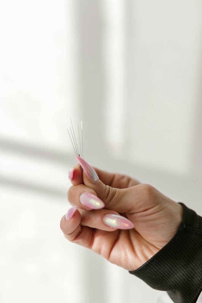 Acupuntura